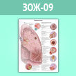 Плакат «Болезни легких» (ЗОЖ-09, ламинированная бумага, A2, 1 лист)